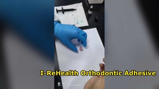 Sistema di bonding ortodontico